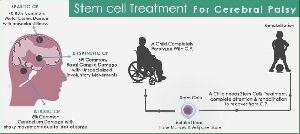 Stem Cell Treatment For Cerebral Palsy
