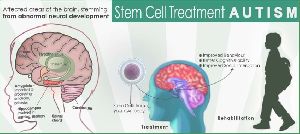 Stem Cell Therapy