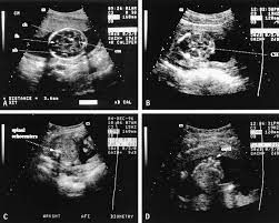 obstetrics sonography service