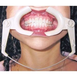 Dental Cheek Retractor