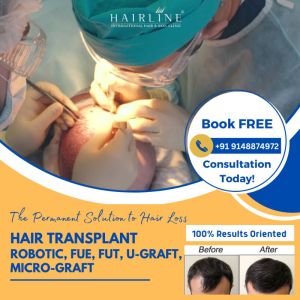 Hair Transplantation - Robotic, FUE, Micrograft, Ugraft