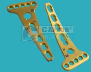 Volar Buttress Locking Plate