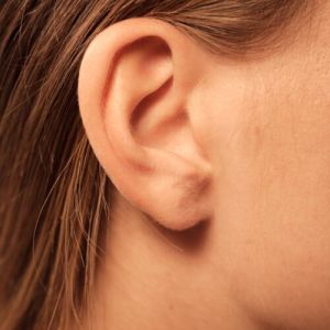 Earlobe Repair Surgery