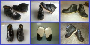 Orthopedic Shoes