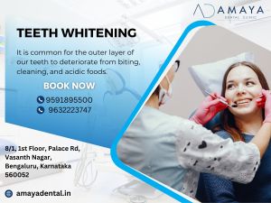 Teeth Whitening Services