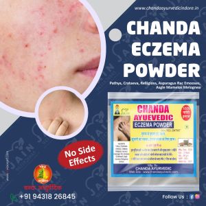 Chanda Eczema Powder