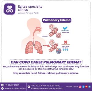 Pulmonology Service