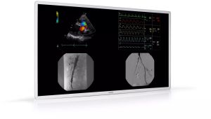 MDAC8355 Surgical Displays