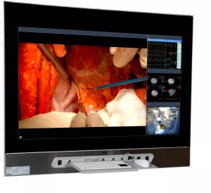 MDMX25500 GNNB Surgical Displays