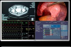 MDSC8255 Surgical Displays