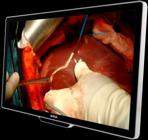 MDSC8532 SSTF / NXF surgical display