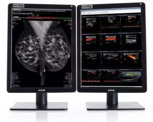 Nio Color 5MP (MDNC-6121) Mammography Display