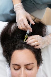 hair growth factor concentrate therapy