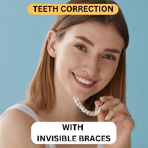 Invisible Braces