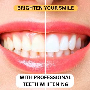 Teeth Whitening