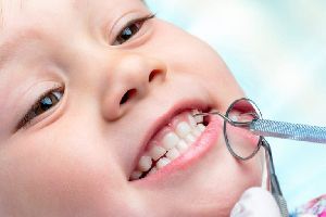 Kids Dentistry Services