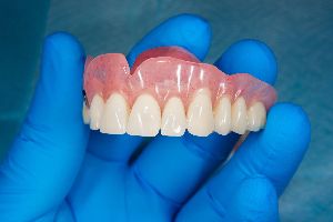 Complete Dentures