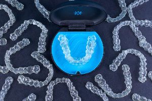 invisalign services