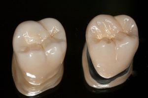 zirconia crowns