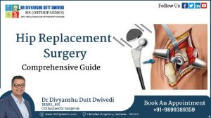 Total Hip Replacement Services