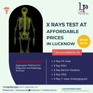 X Ray Test in Lucknow