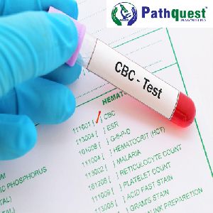 CBC blood testing