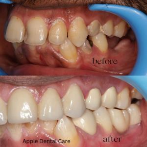 dental treatment services in Coimbatore