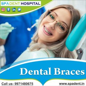 dental braces