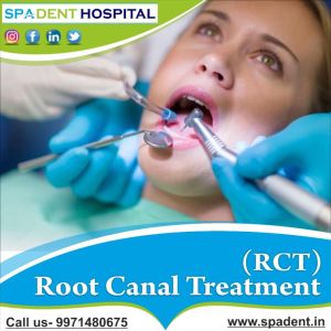 Root Canal Treatment