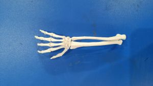 3d printed medical model