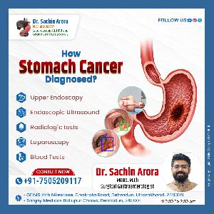 Cancer of the Stomach (Gastric Cancer): An Overview