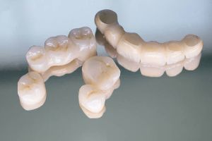 Cosmetic Fillings