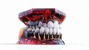 Dental Bonding