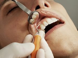 Root Canal Therapy