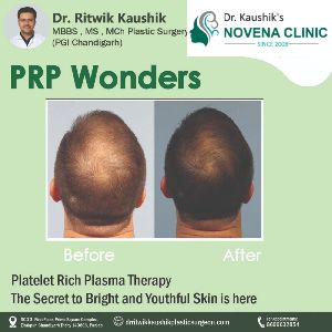 follicular hair transplant