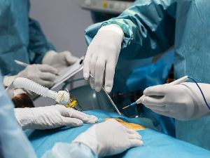 hernia repair surgery