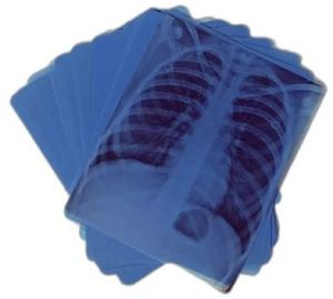 Blue X Ray Film