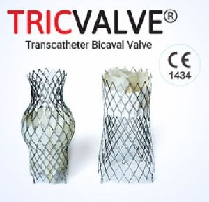 TRICVALVE-Transcatheter Bicaval Valves System