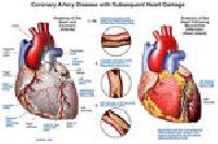 Heart Diseases Medicine