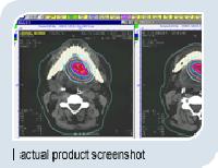 TSG Asha 3D Brachytherapy Planning System