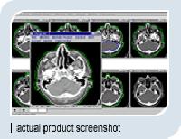 TSG Asha 3D XRT Planning System