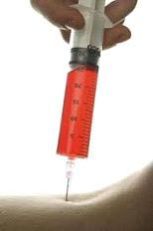 Neurological Injection