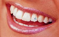 Dental Jewellery