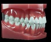 dental model