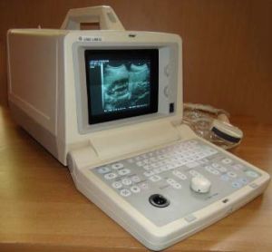 GE Black & White Ultrasound Machine (LOGIQ 100 CL)