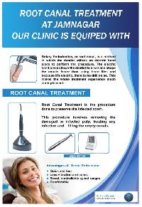 Root Canal Treatment