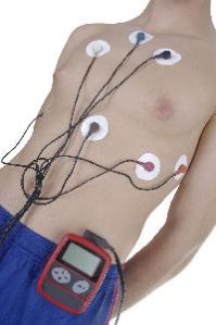 Holter Monitor