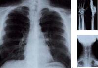 X-ray Films