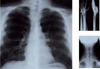 medical x-ray films