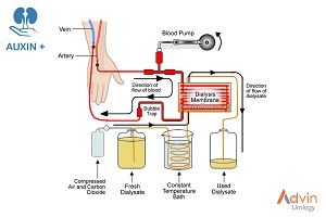 Haemodialysis dry powder